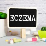 Eczema Lekarz z tablicą na białym tle