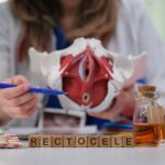 Kompletny model medyczny ilustrujący stan rectocele w nauczaniu anatomii miednicy