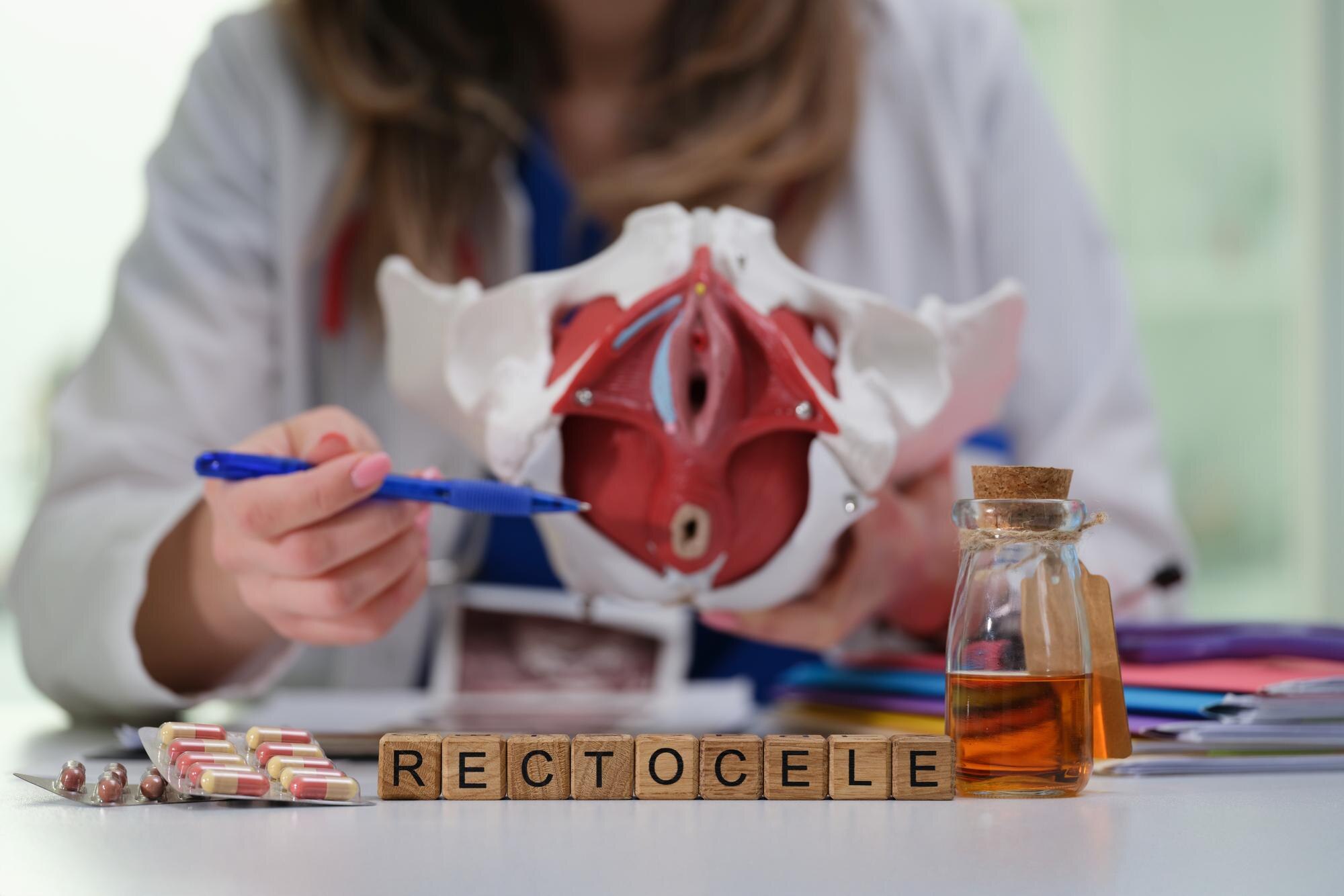 Kompletny model medyczny ilustrujący stan rectocele w nauczaniu anatomii miednicy